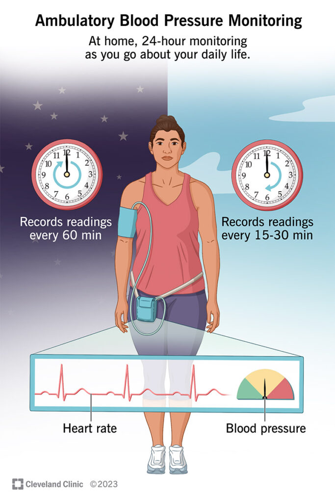 16330 ambulatory blood pressure monitoring.ashx