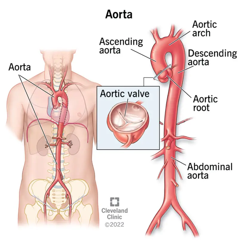 17058 aorta anatomy