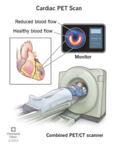 17376 cardiac pet scan