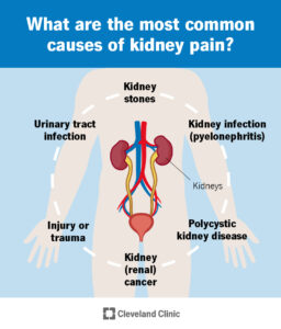 17688 kidney pain