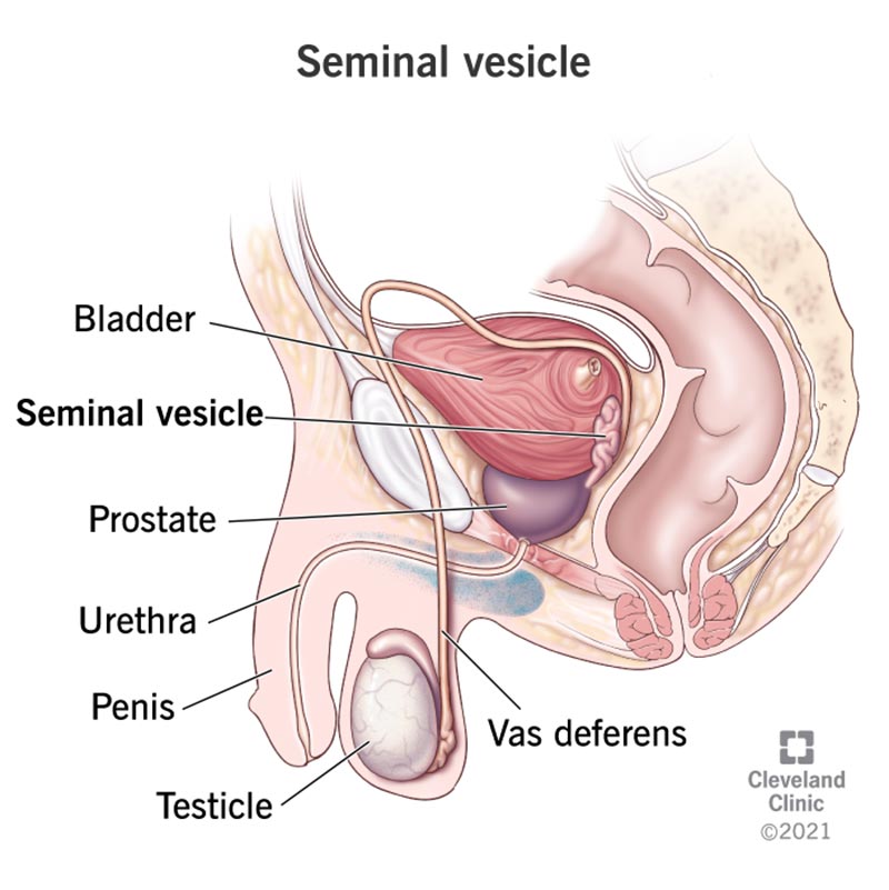 22433 seminal vesicle 2446360