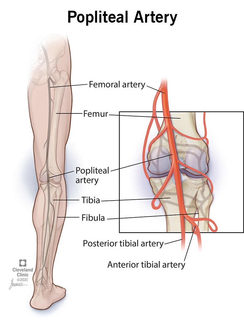Kojos arterijos, įskaitant poplitealinę arteriją.