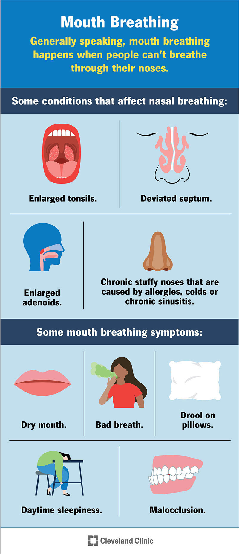 Kvėpavimas per burną sukelia viršutinės eilės kairę pusę: padidėjusios tonzilės ir nukrypusi pertvara.  Antra eilė kairėje pusėje: padidėję adenoidai ir lėtinis nosies užgulimas nuo alergijos, peršalimo ar lėtinio sinusito.  Kvėpavimo per burną simptomai viršutinėje eilutėje kairėje pusėje: burnos džiūvimas, blogas kvapas ir seilėtekis ant pagalvės.  Antra eilė kairėje pusėje: dienos mieguistumas ir netvarkingas sąkandis.
