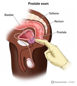 22764 prostate exam