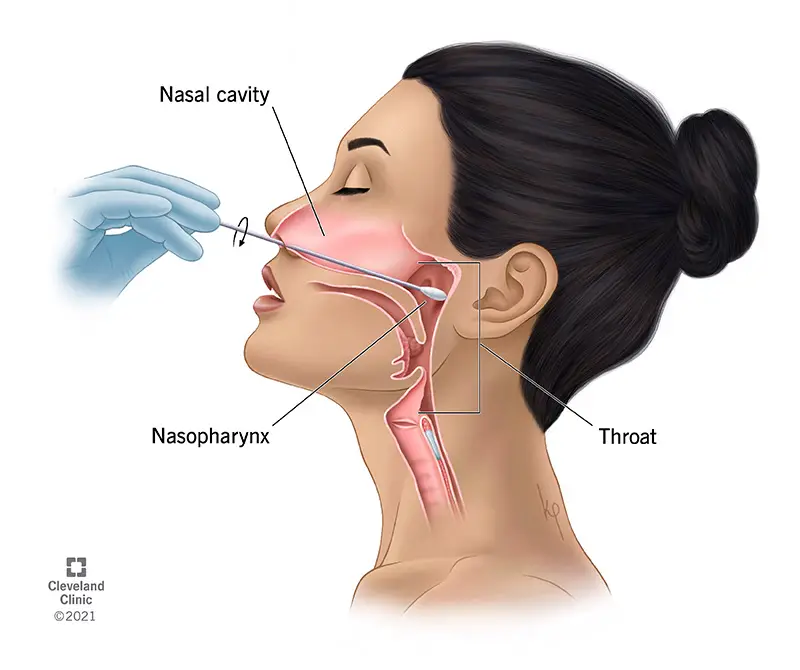 22878 nasopharyngeal swab