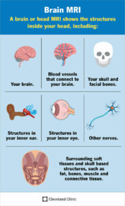 22966 brain mri