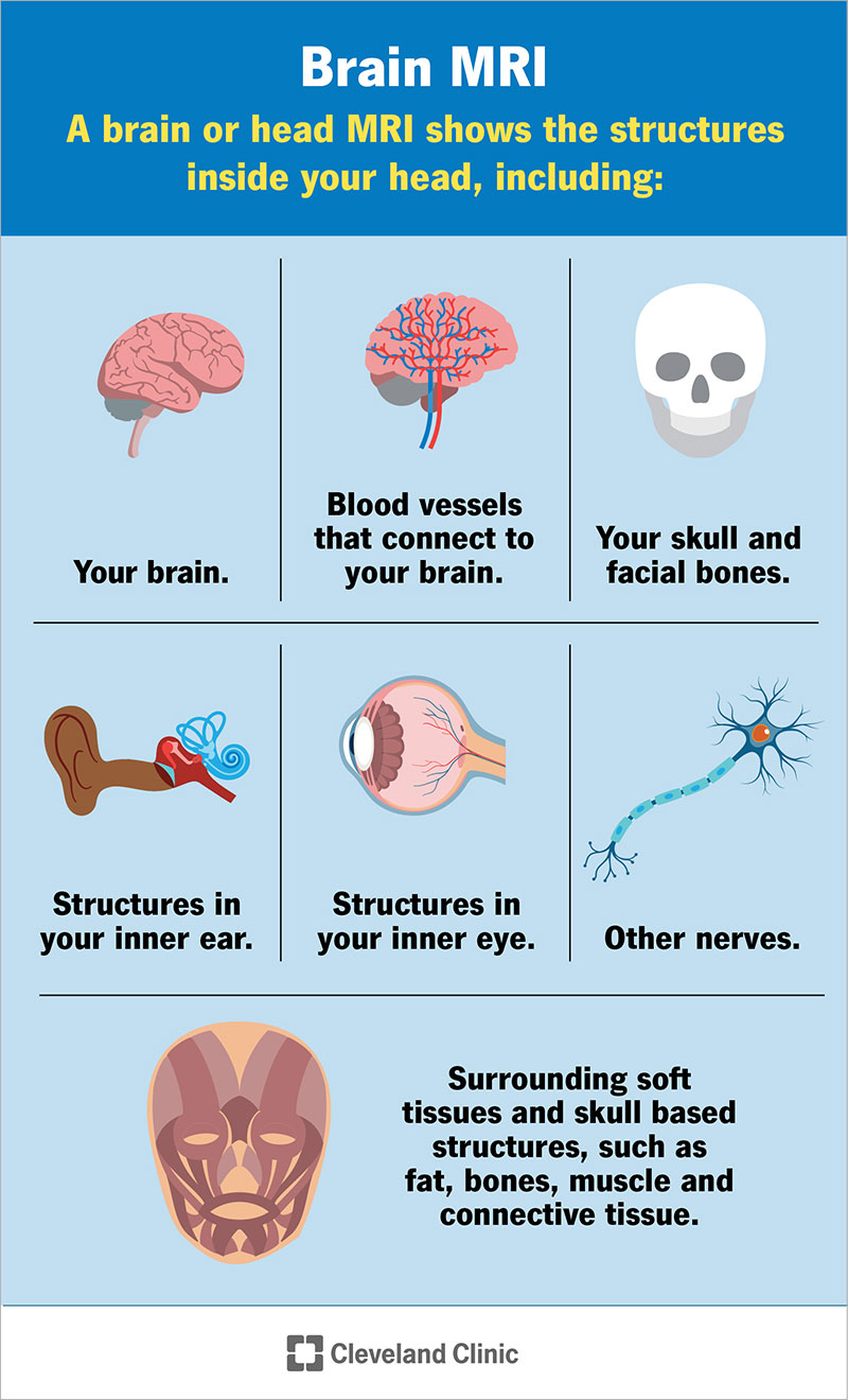 Smegenų arba galvos MRT parodo jūsų smegenis, kraujagysles, kaukolę, vidinės ausies ir vidinės akies struktūras ir kt.