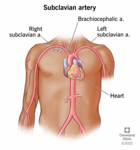 23990 subclavian artery