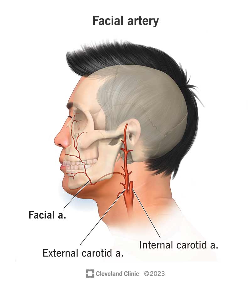 24988 facial artery