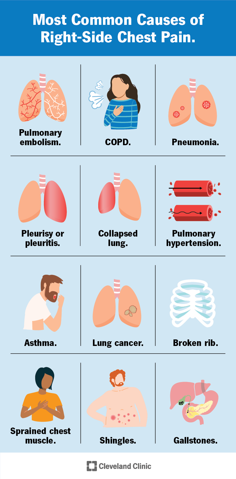 Daugelis dešiniojo krūtinės skausmo priežasčių yra jūsų plaučiuose.