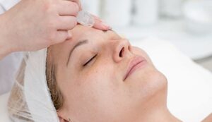 25124 microdermabrasion