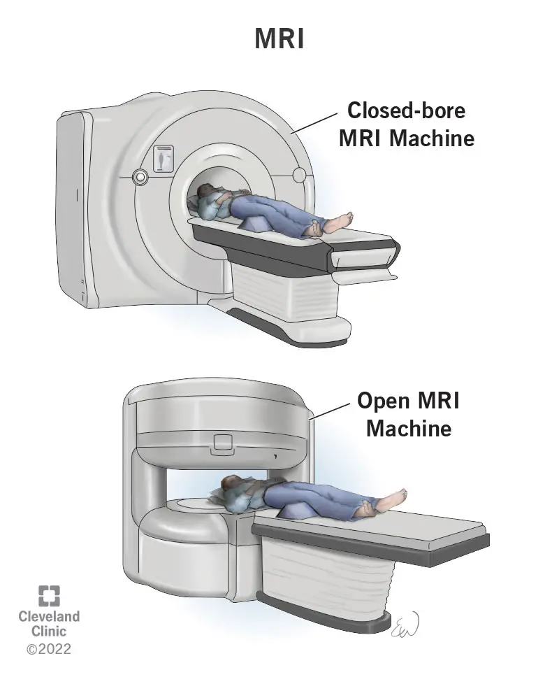 4876 mri