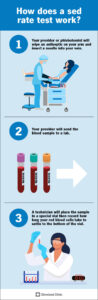 sed rate test