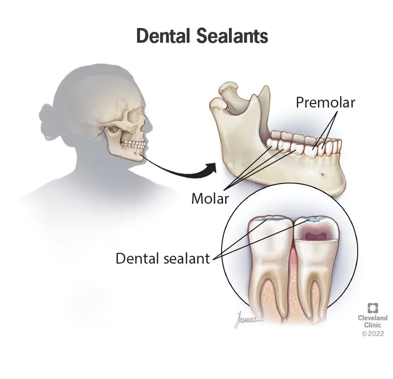 10912 sealants