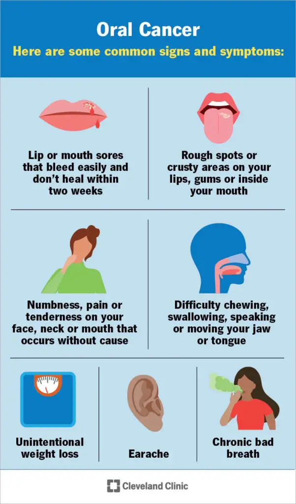 11184 oral cancer