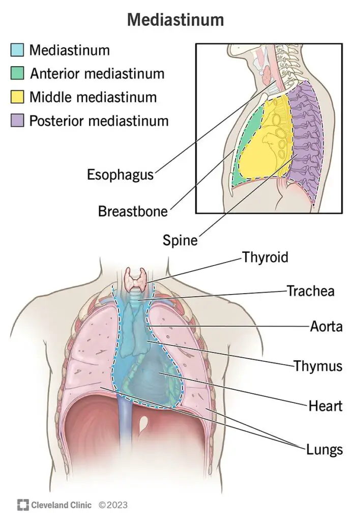 13792 mediastinal tumors