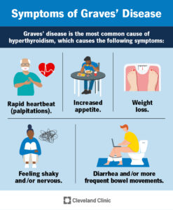 15244 graves disease