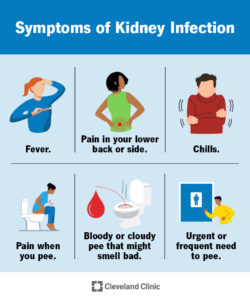 15456 kidney infection