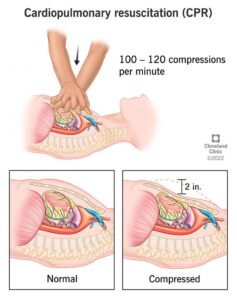 17680 cpr instructions