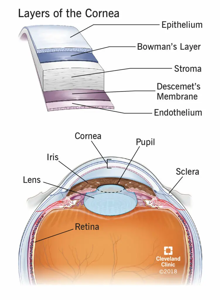 17714 cornea transplant