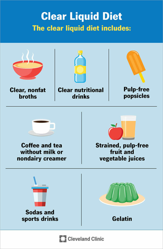 21764 clear liquid diets infog final.ashx