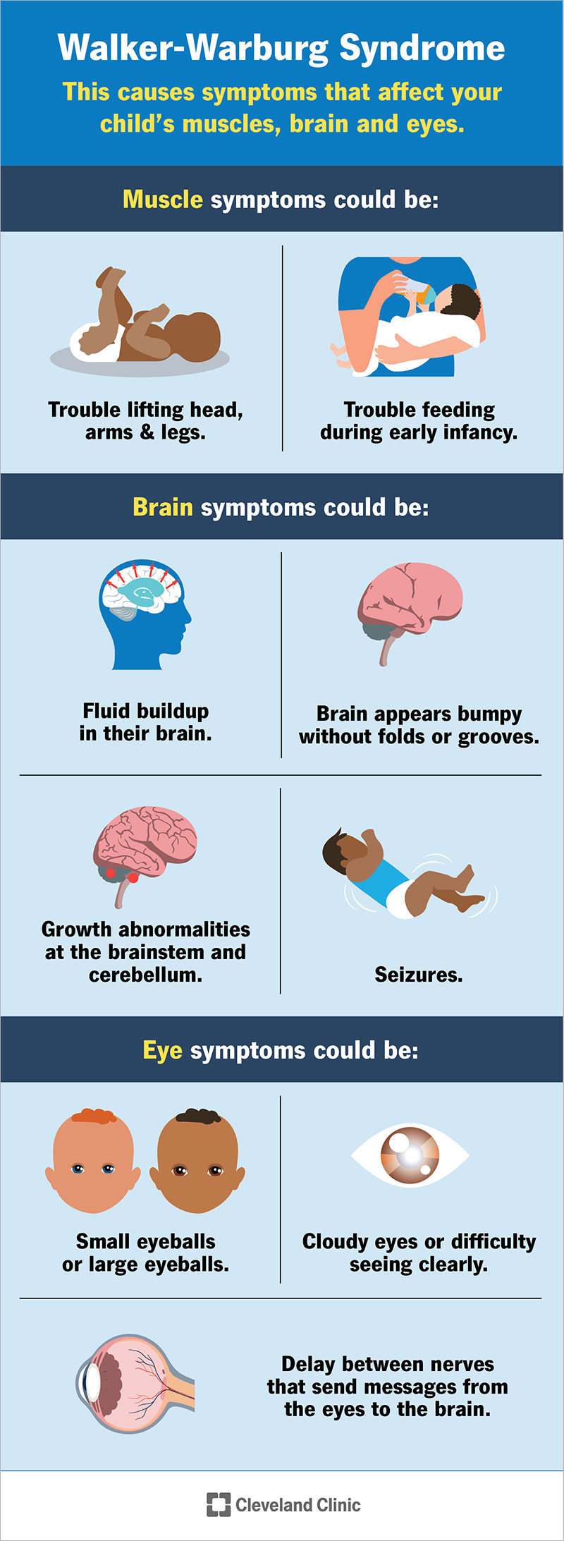 Walker-Warburg sindromo simptomų, turinčių įtakos vaiko raumenims, smegenims ir akims, sąrašas.