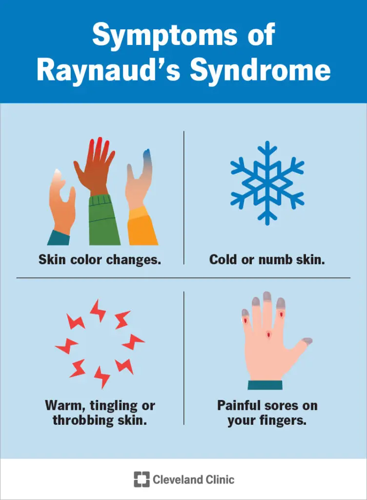 9849 raynauds syndrome