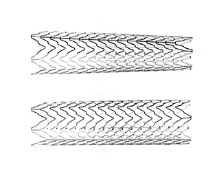 acculink carotid stent 303