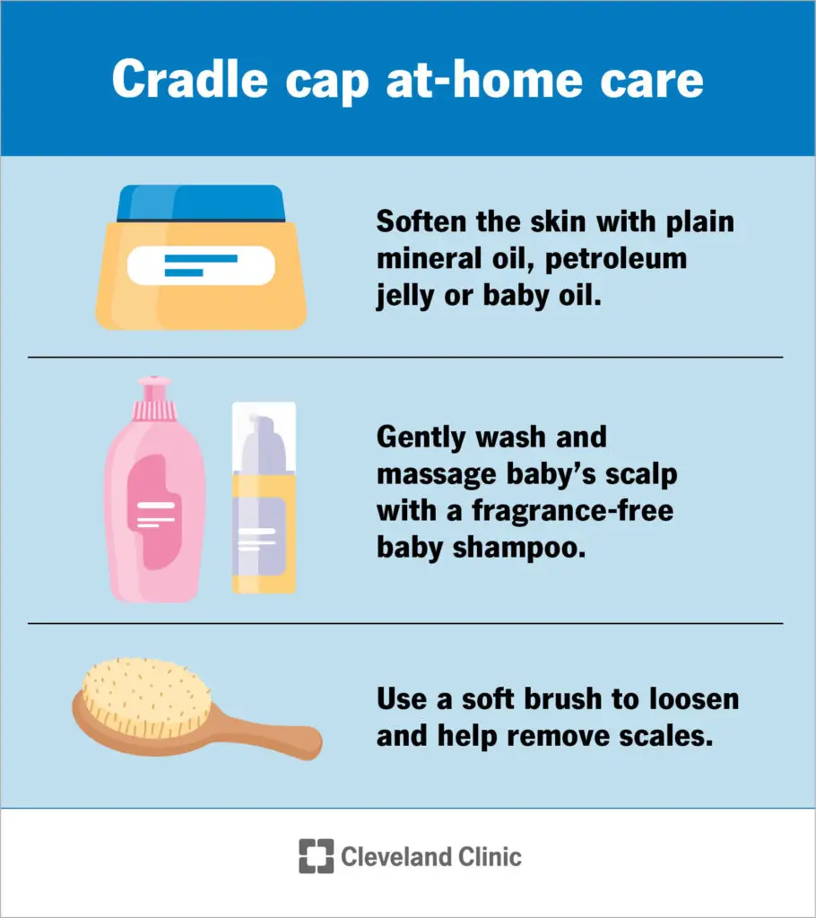 15786 cradle cap