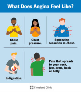 21489 angina