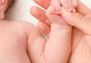 newborn skin peeling 1165471859 770x533 1 jpg