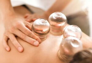 cuppingTherapy 1246919695 770x533 1 jpg