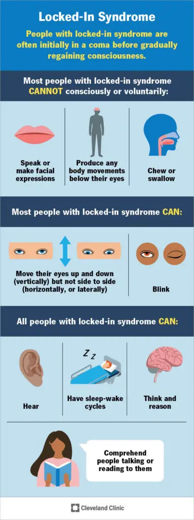 22462 locked in syndrome