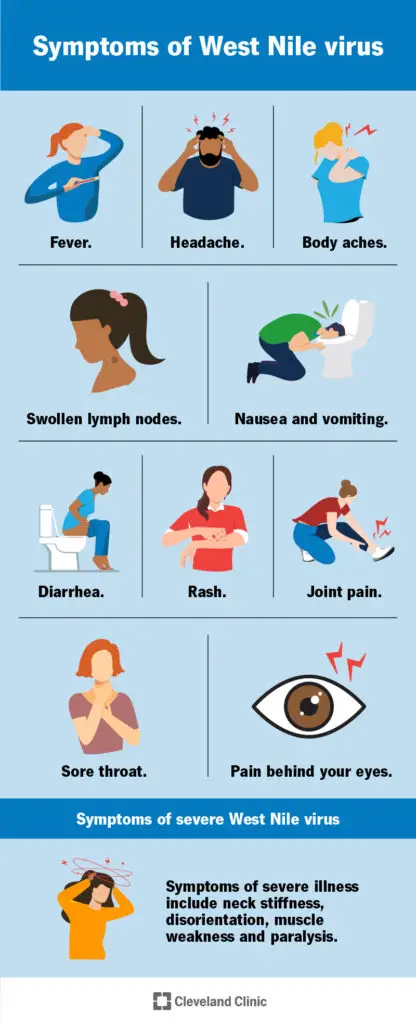 west nile virus