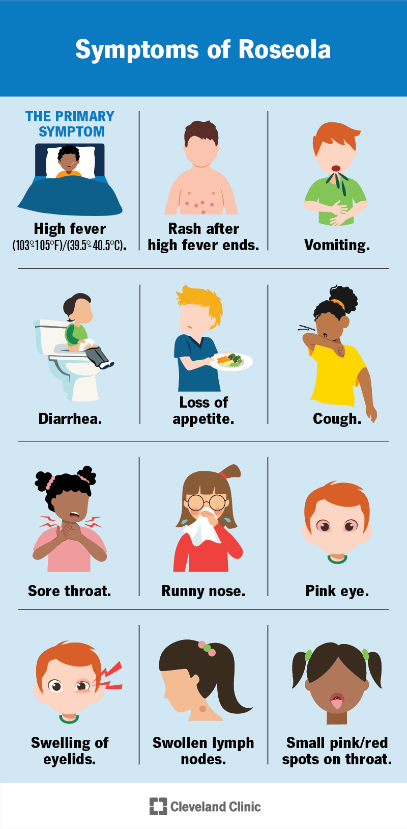 Infografija, kurioje parodytas pagrindinis roseola (didelio karščiavimo) simptomas kartu su daugeliu kitų galimų simptomų.