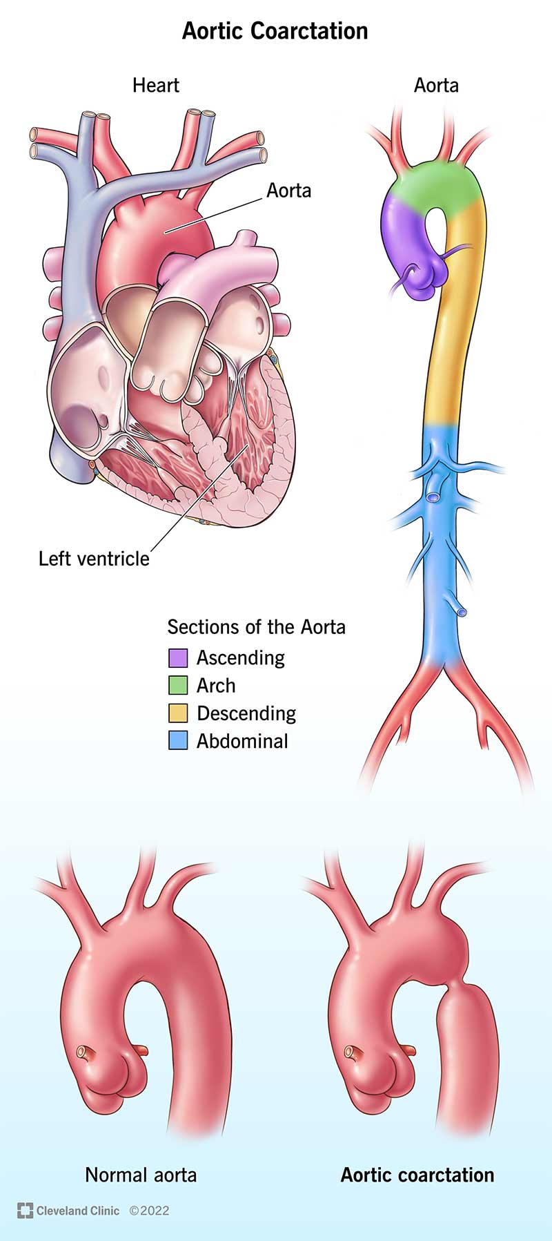 Grupė iliustracijų, parodančių širdies ir aortos anatomiją.