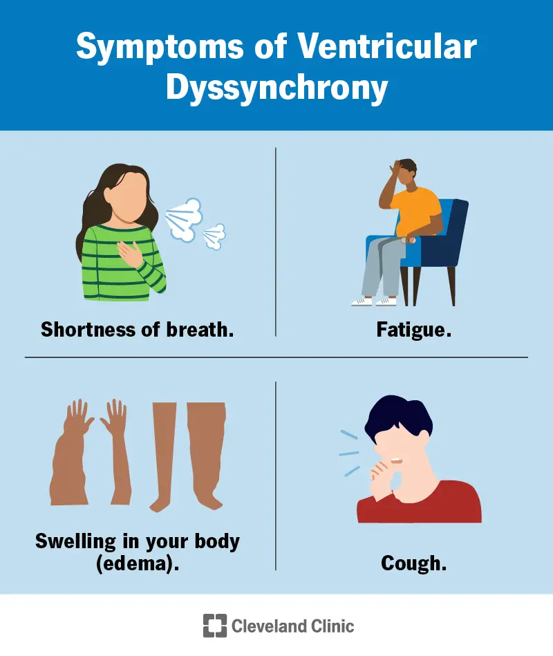 1725242416 24279 ventricular dyssynchrony cv