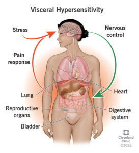 1725900934 22997 visceral hypersensitivity