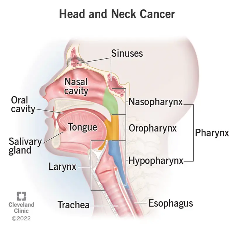 1727489417 14458 head and neck cancer