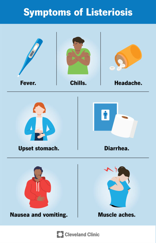 17721 symptoms of listeriosis