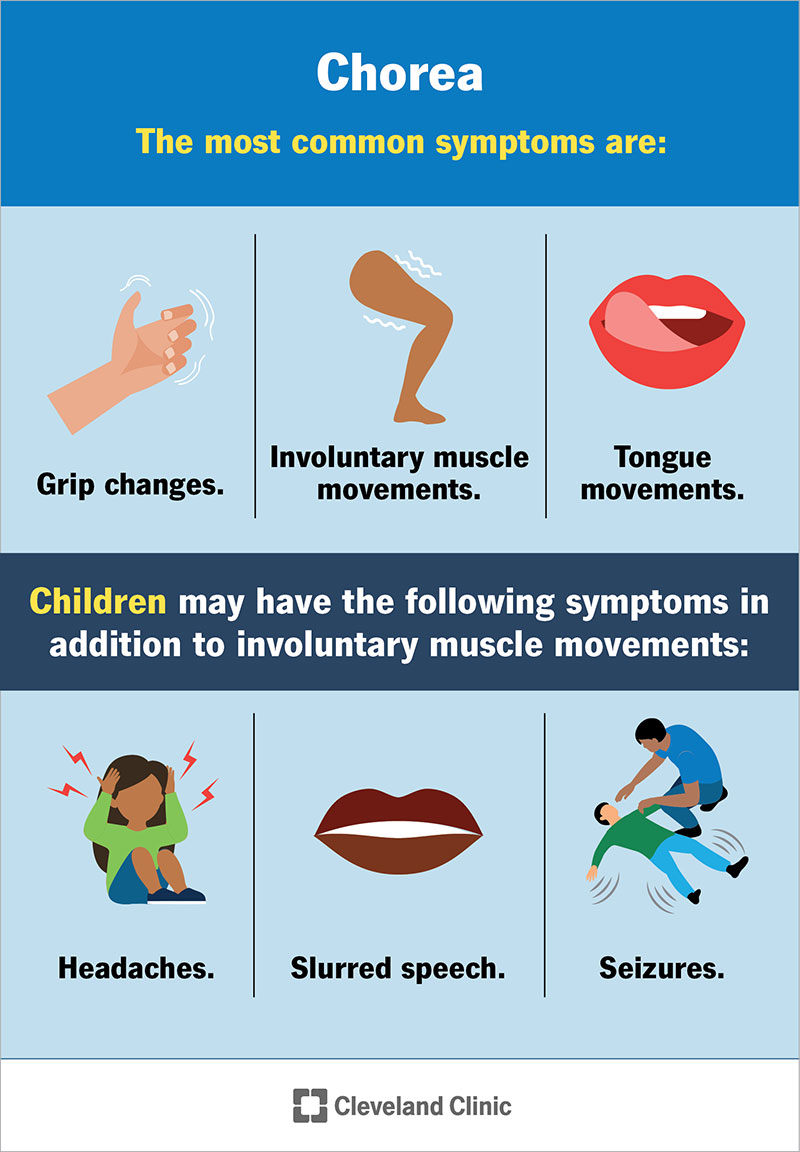 Chorėjos simptomai suaugusiems ir vaikams.