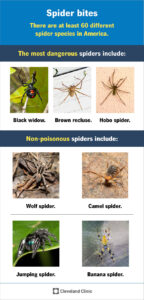 spider bites